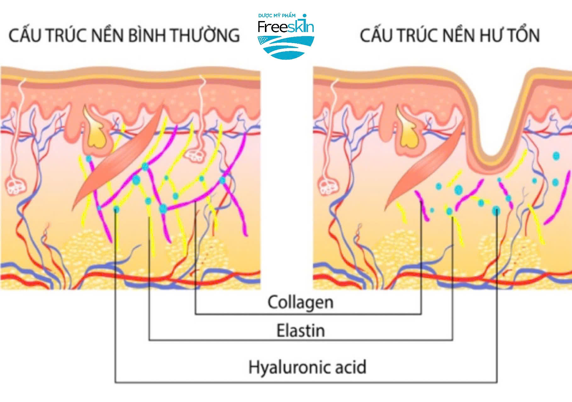 Cấu trúc da dần thay đổi