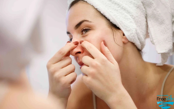 Cạy nặn mụn không đúng cách